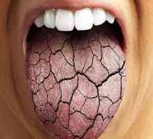 Principalele cauze ale uscăciunii gurii pe timp de noapte