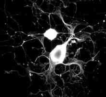 Procesele neuronilor: definiție, structură, tipuri și funcții