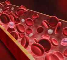 Pancitopenia este o afecțiune patologică în care compoziția tuturor elementelor din sângele…