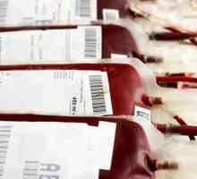 Transfuzia de sânge pe grupe de sânge: reguli. Donatorii universali. Tabel de compatibilitate a…