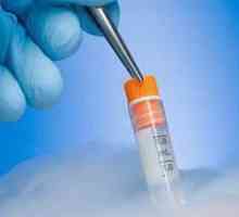 Transferul de embrioni crioconservați. Fertilizarea in vitro