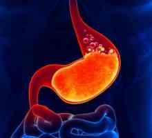 Nutriție cu exacerbarea gastritei: dietă terapeutică