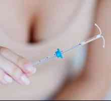 Pro și contra dispozitivului intrauterin de la sarcină