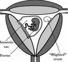 Fructless ou fără embrion. Poate un ovul fetal să nu aibă un embrion?