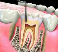 Umplerea canalelor dintelui: metode și materiale