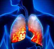 Pneumonie eozinofilică: descriere, simptome, cauze și caracteristici ale tratamentului