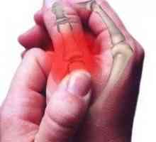 De ce doare articulația degetului?