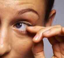 De ce ochiul stâng se răstoarnă: cauzele cele mai probabile
