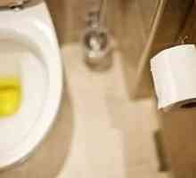 De ce este galbenul urinei?