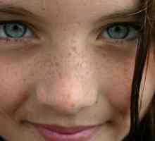 De ce pe fața sunt pete pigmentare: motivele cele mai probabile