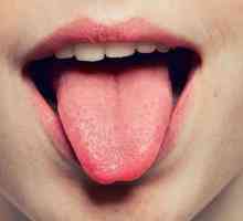 De ce se suprapune limba: cauze, simptome de boli, tratament