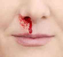 De ce copilul are sânge din nas: cauzele și consecințele