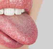 De ce tricoturi în gură: cauzele, simptomele și caracteristicile tratamentului
