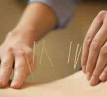 Beneficiile acupuncturii, indicații și contraindicații, recenzii