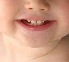 Ordinea și schema de dentiție în copil