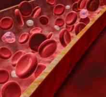 Creșterea proteinei în sânge: cauze. Test de sânge biochimic. Proteină totală