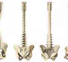 Coloana coloanei vertebrale: este periculoasă sau nu?