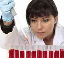 Cauzele ESR crescute în sânge la femei, diagnostic, tratament