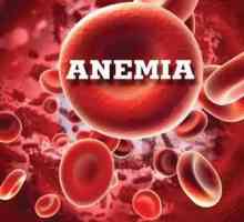 Cauzele, prevenirea și semnele anemiei la femei: trăsături de tratament