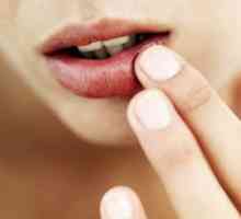 Cauzele și tratamentul fisurilor în colțurile buzelor