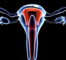 Cauzele chisturilor pe cervix, tratament, fotografie