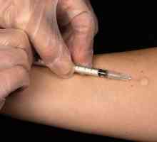 Vaccinarea cu mantoux: normă, abatere