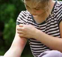 Prevenirea și tratamentul mușcăturilor de țânțari la copii
