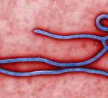 Prevenirea febrei Ebola. Febra febrei: simptome, tratament