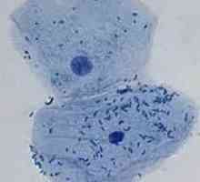 Celula procariotică este celula organismului pre-nuclear