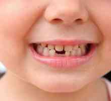 Dentitia si cresterea dintilor la copii: masa. Totul despre erupția dinților sugarilor la sugari