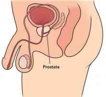Prostatul este ... Masajul prostatei: beneficiu