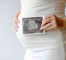 Psoriazisul și sarcina: tratamentul, posibilele consecințe