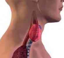 Iod radioactiv: tratamentul patologiilor tiroidiene