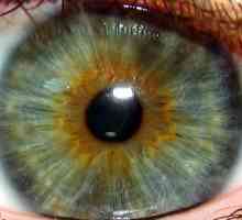 Iris de ochi: culoare, pete, boli