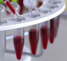 Decodificarea testului de sânge pentru HCT, normă