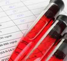 Decodarea testelor de sânge biochimice la adulți (tabel). Test de sânge biochimic la copii:…