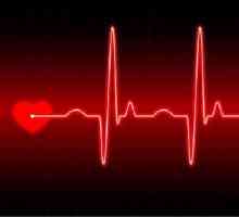 Decodarea ECG a inimii