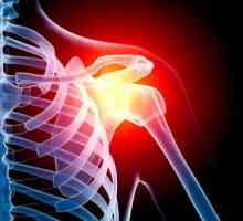 Tensiunea ligamentelor articulației umărului: simptome și tratament