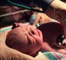 Resuscitarea neonatală: indicații, tipuri, etape, medicamente