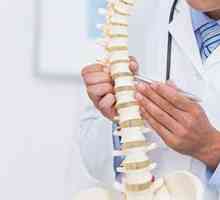 X-ray a coloanei vertebrale lombare: numire, caracteristici de realizare și decodare