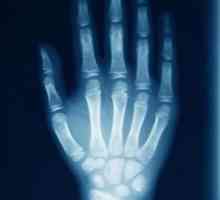Razele de mână pentru boli și vătămări