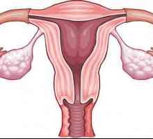 Retrovascularizarea uterului: cauze și tratament