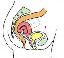 Retroflexia uterului: cauze, simptome și tratament