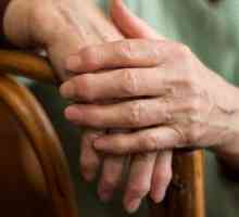 Artrita reumatoidă a degetelor: primele simptome, cauze și tratament