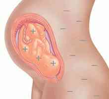 Factorul de rhesus în planificarea sarcinii: recenzii
