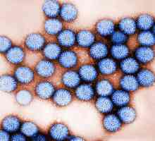 Infecția cu rotavirus: simptome la adulți și copii, tratament