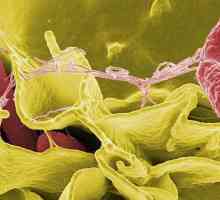 Salmonella tifimurium - agent patogen, diagnostic, tratament