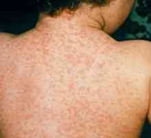 Cele mai frecvente boli ale pielii: trăsături și posibile cauze