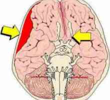 Compresia creierului: tipuri, simptome, diagnostic și tratament