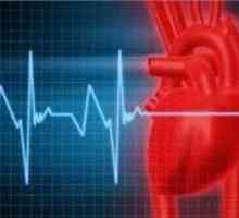 Aritmie cardiacă. Semne. motive